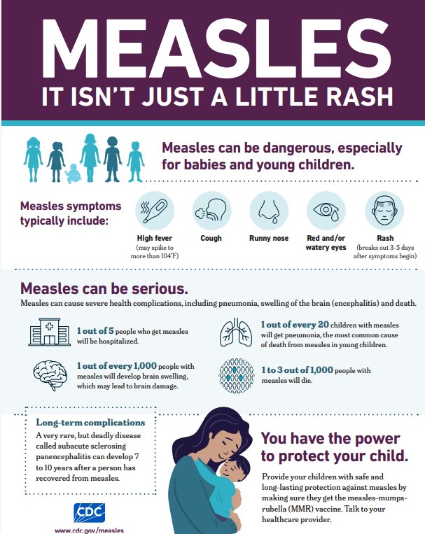 Measles