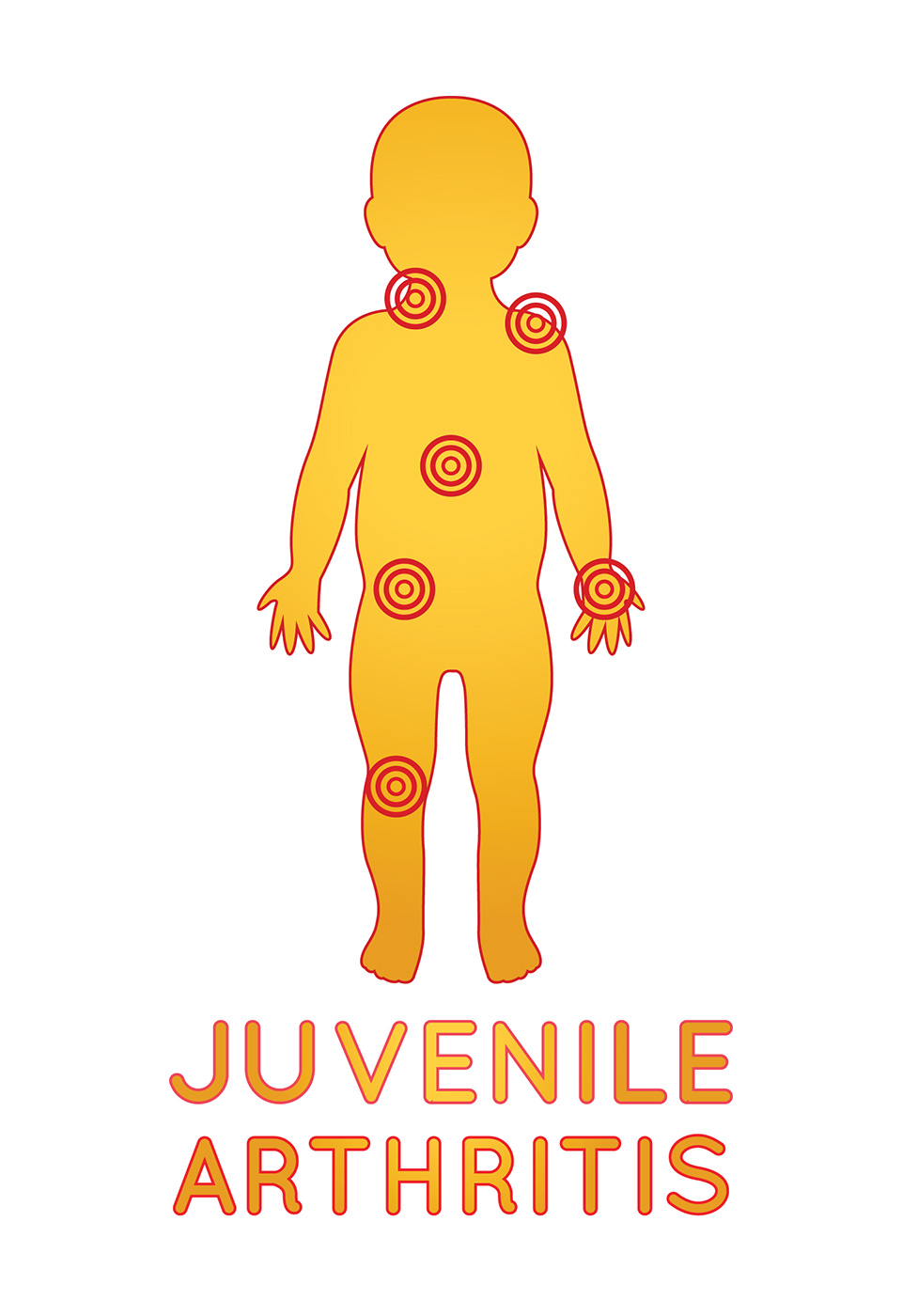 Juvenile Arthritis clip art
