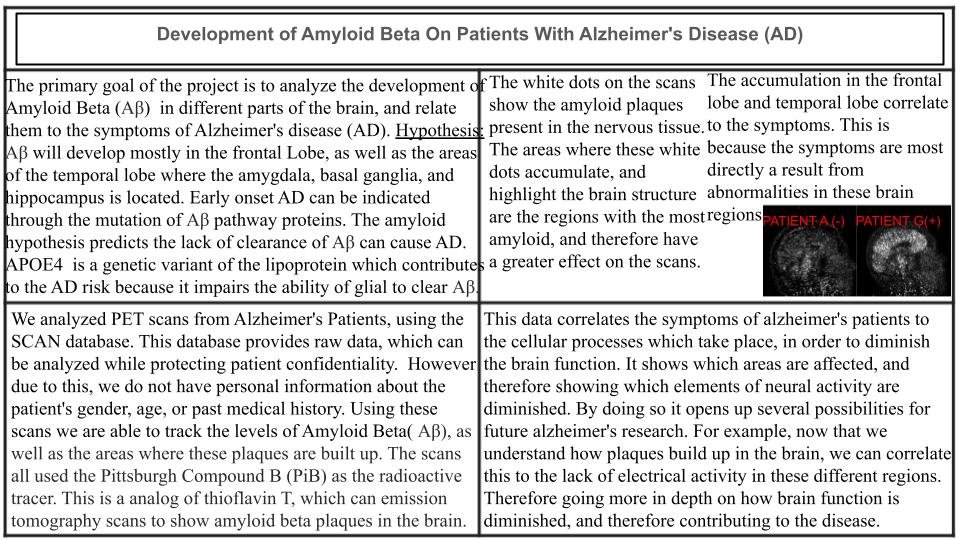 Development of Amyloid Beta On Patients With Alzheimer's Disease