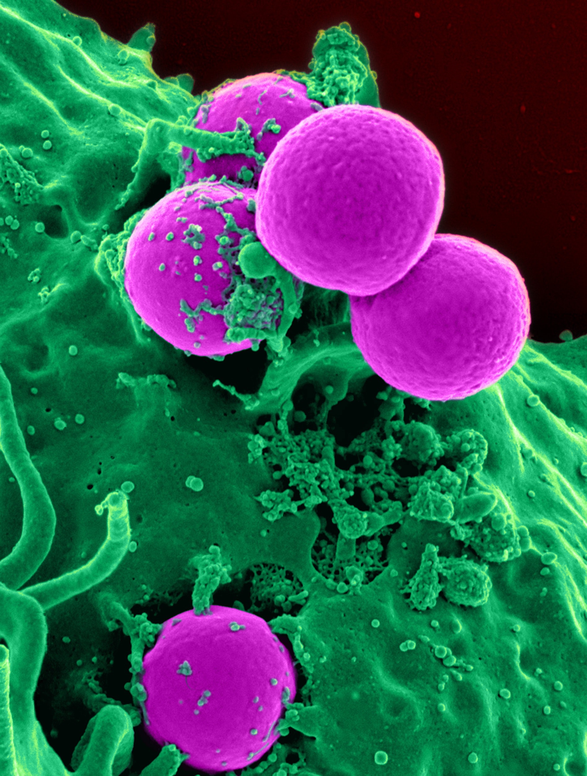 An image of purple cells.