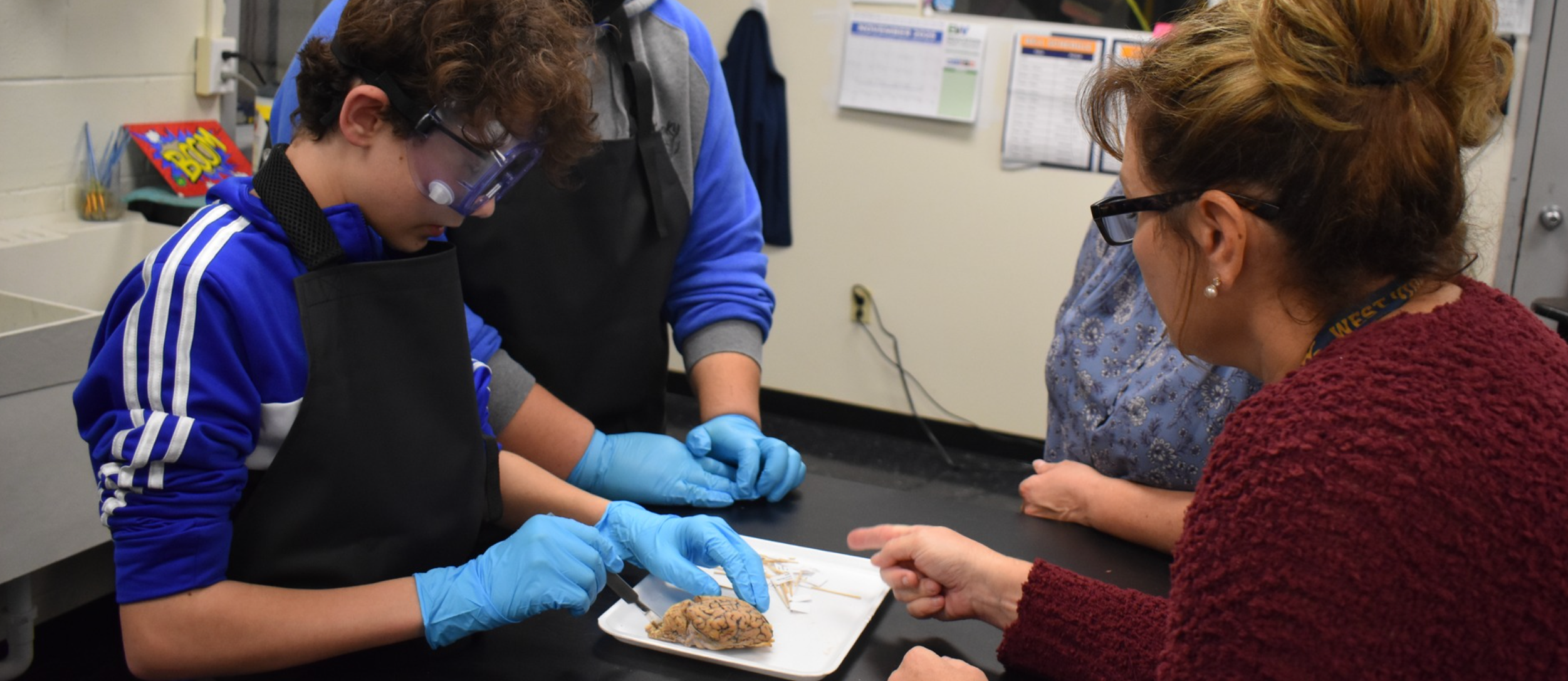 Brain dissection