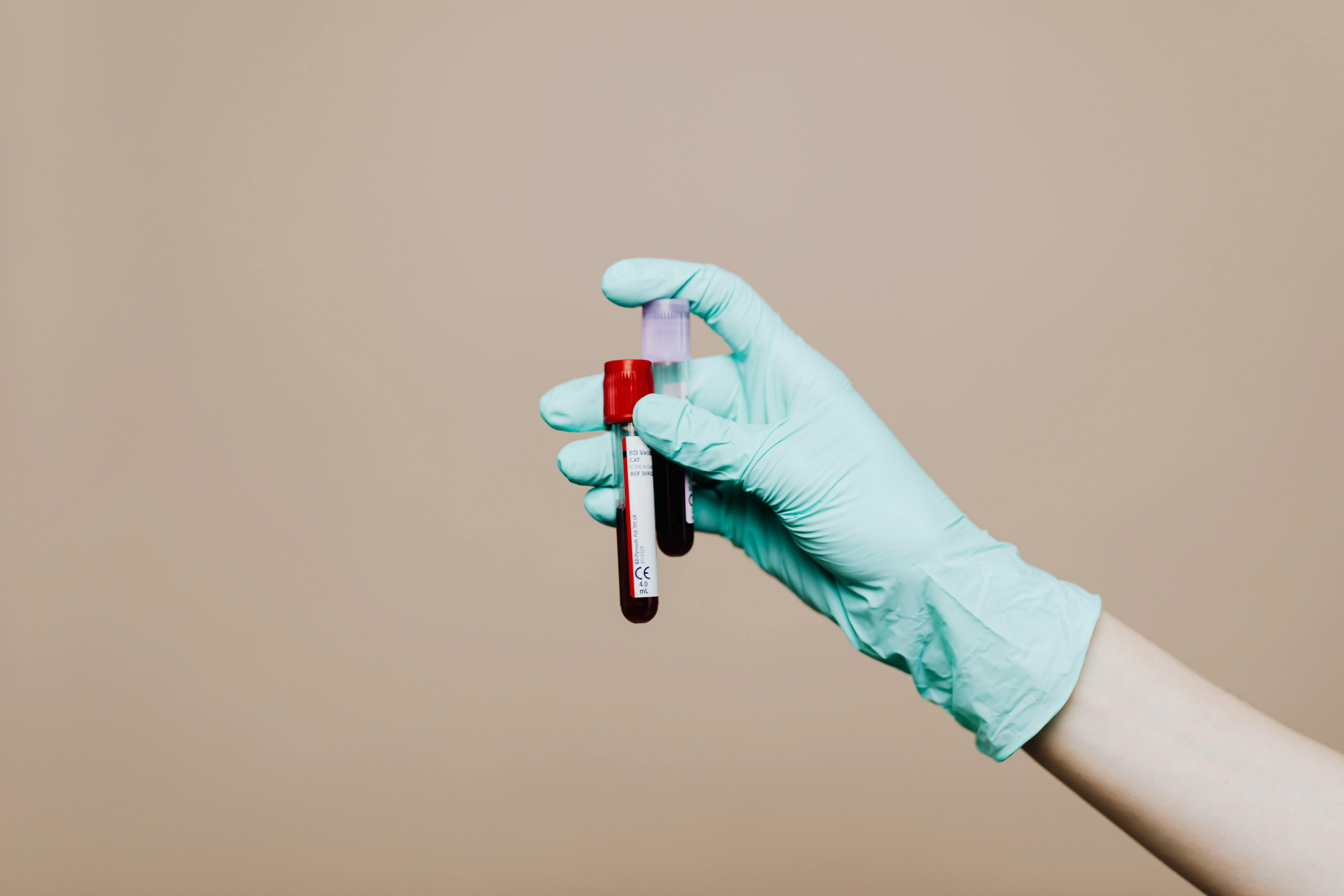 Vials of blood held by a gloved hand