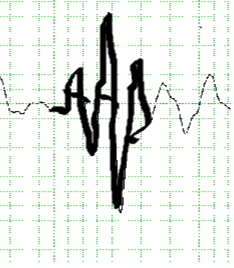 medical sign waves 