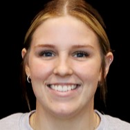 Brinley Deibler