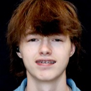 Kyle Carson