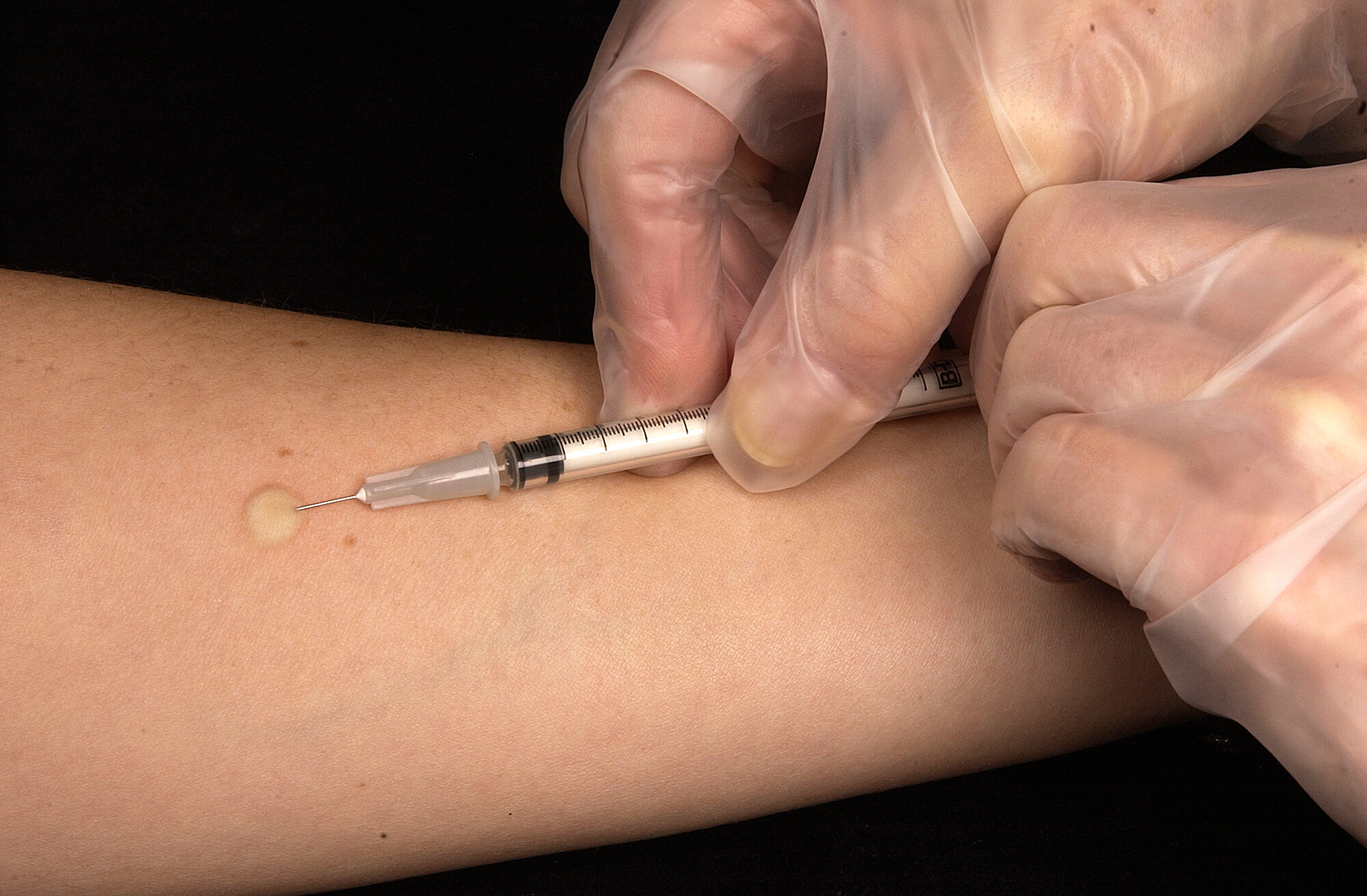 A close-up of a person getting an injection in their arm