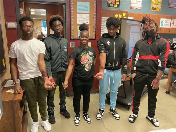 Group of individuals with arm markings standing together in a school setting.