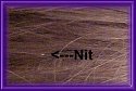 Close-up image of hair strands with a labeled nit positioned to the left, indicating a possible lice infestation.