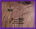 Close-up of hair showing nits, with labels indicating their presence and describing their shape, on a purple background.