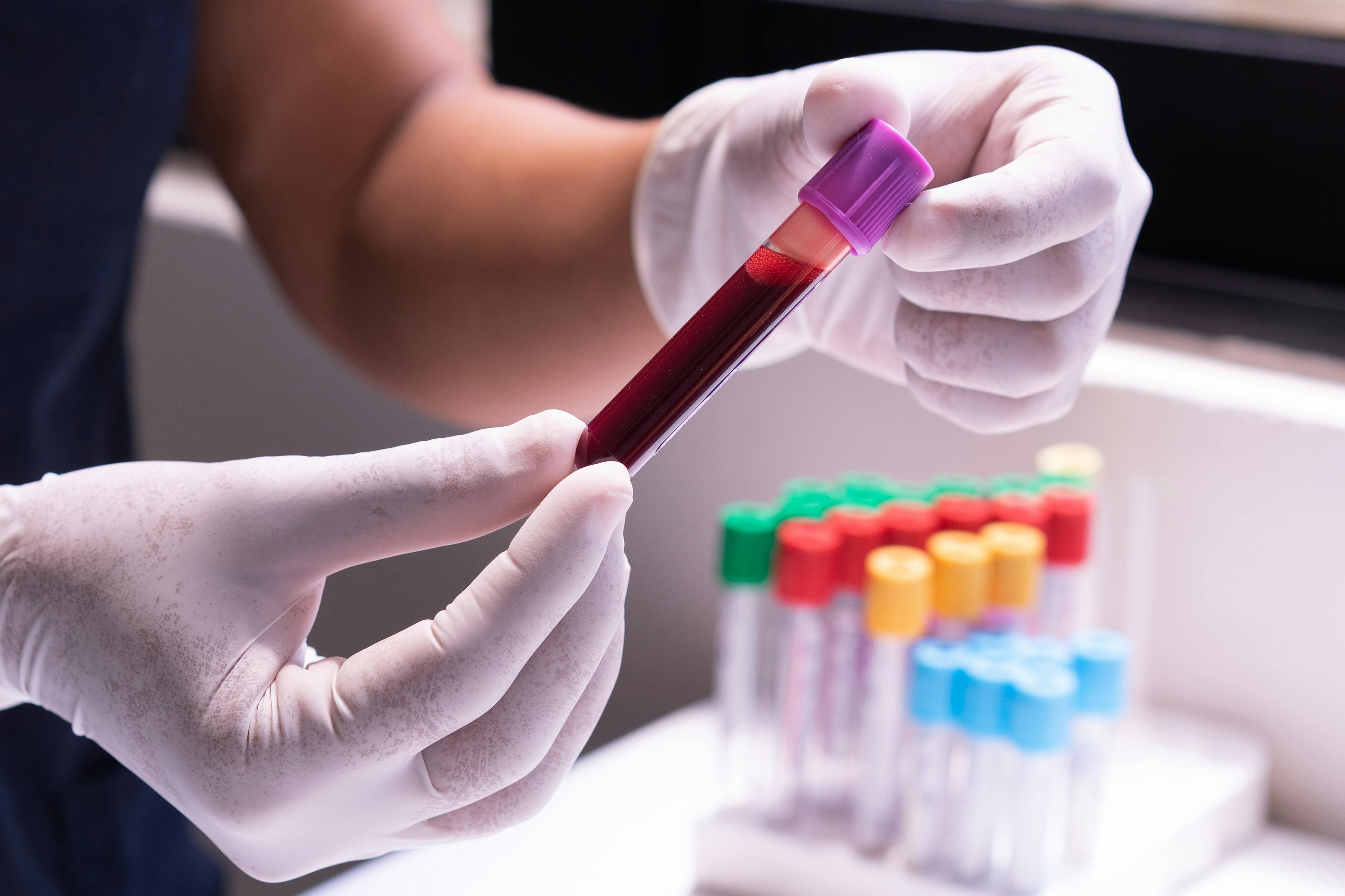 Close up of student holding blood collection tube with empty tubes in background.
