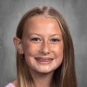 Londyn Albertson