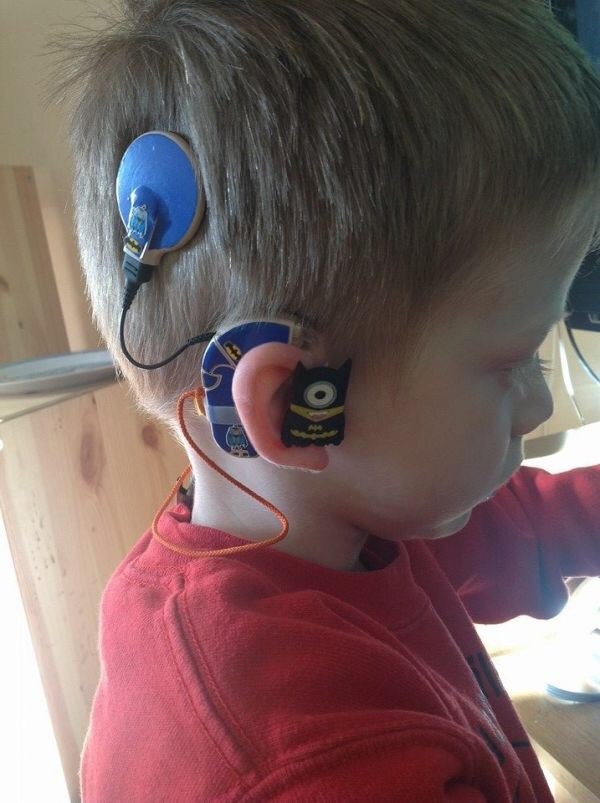 Young boy with hearing device