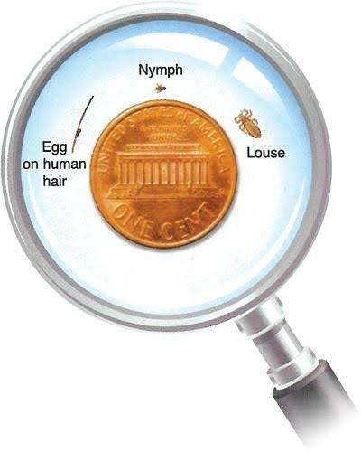 Head Lice