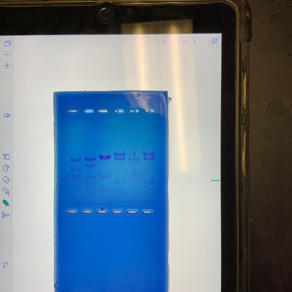 DNA samples through PCR and Electrophoresis