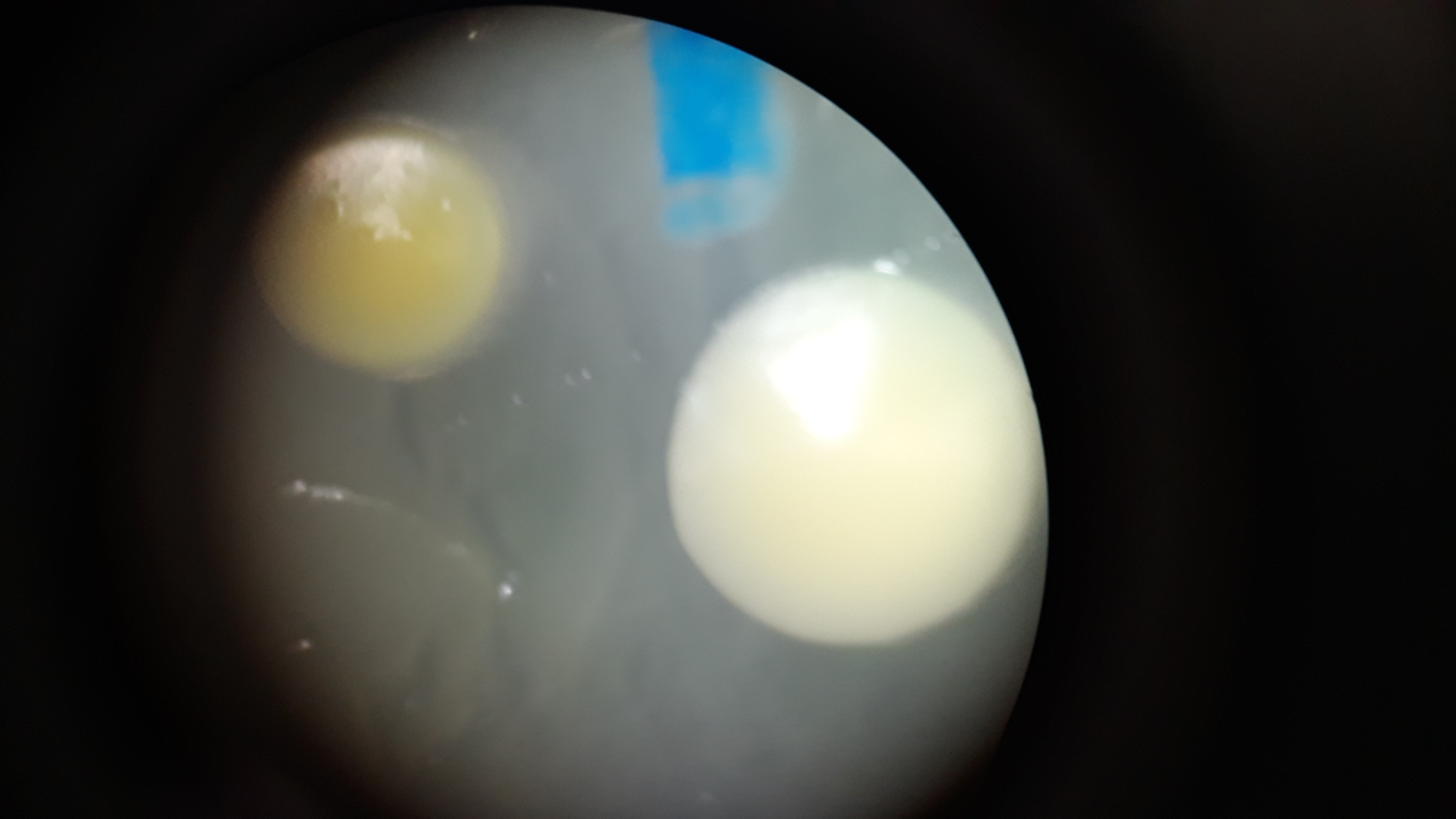 Bacterial Colonies