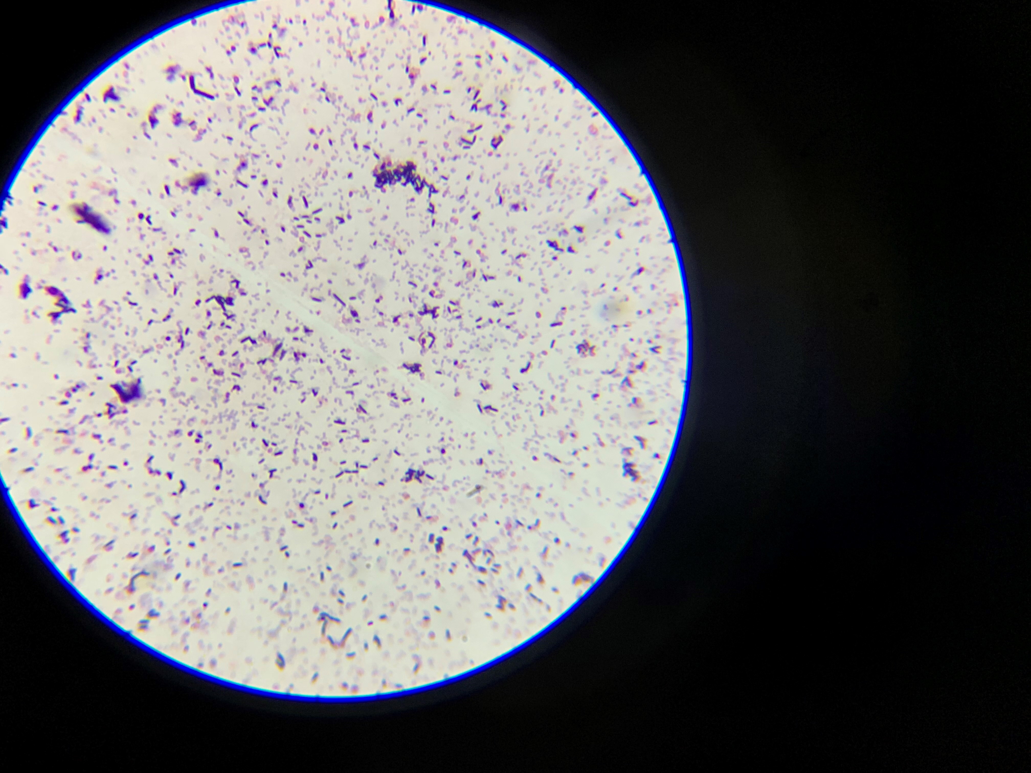 Kaden's Gram Stain Slide